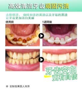 牙齿美容液 专业护牙高级套装插图2